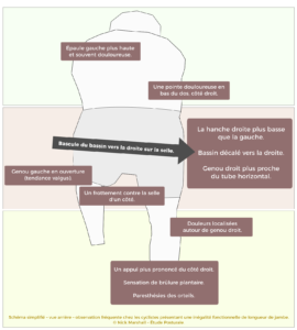 Guide visuel douleurs gênes vélo étude posturale.